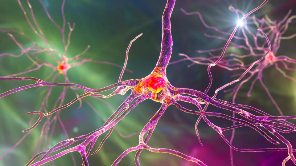 Illustration of neurons, their cell body (soma) is pink and yellow, the dendrites and axons are the color purple. 