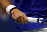 Novak Djokovic of Serbia bleeds from his right wrist after falling in the first set against Roger Federer of Switzerland during their men's singles final match at the U.S. Open Championships tennis tournament in New York, September 13, 2015. REUTERS/Mike Segar