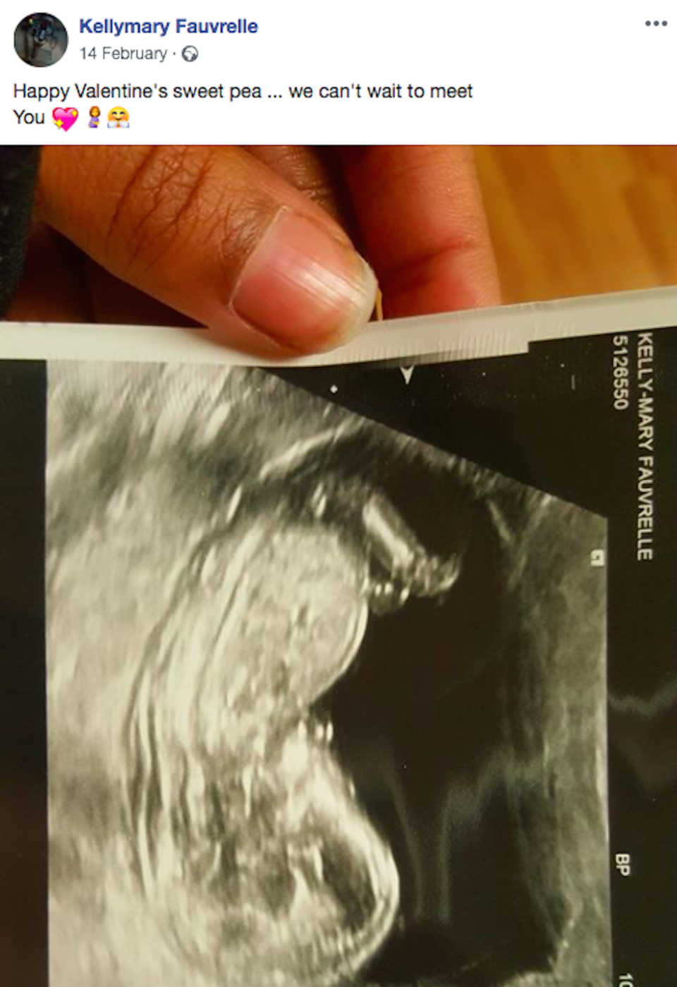 A Facebook message posted by Ms Fauvrelle in February with a photo of her ultrasound scan (Picture: Facebook)