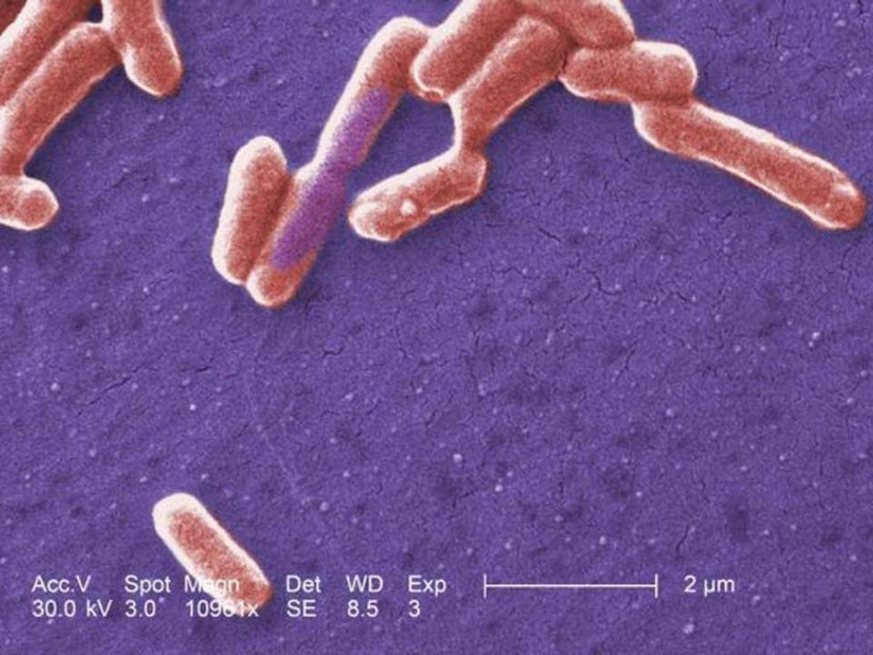 E coli can survive in higher oxygen environments than the normal colon (CDC/Janice Haney Carr)