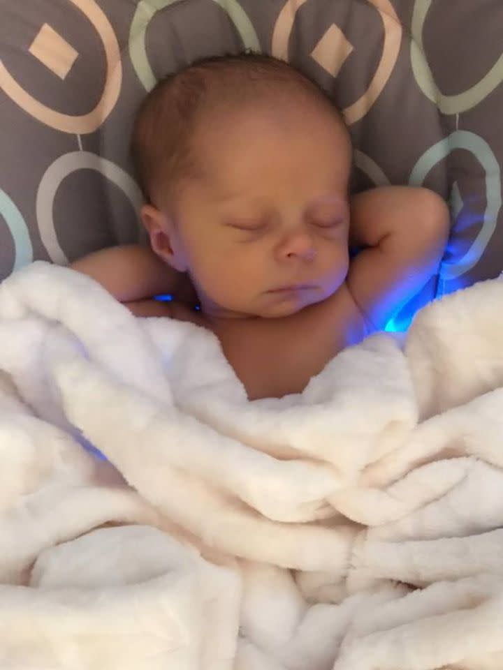 Baby Michael schläft wegen seiner Erkrankung auf einem blauen Licht. (Bild: Sarah Kelleher Steppling)