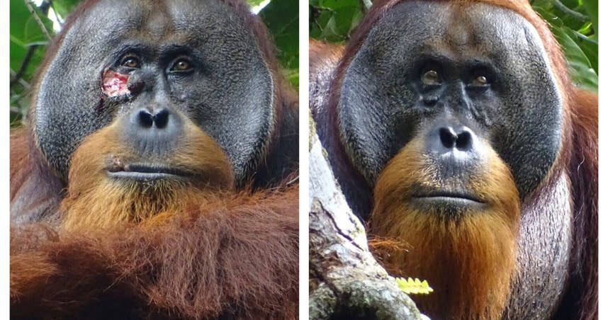科學家在印尼觀察到一隻蘇門答臘猩猩咀嚼完植物後，竟將汁液塗抹在傷口上。（圖／達志／美聯社）