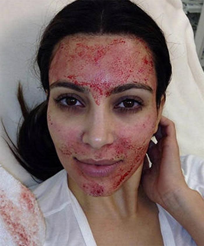 The weirdest beauty treatments that will blow your mind