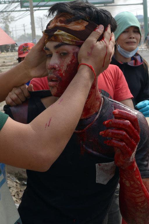 A wounded Cambodian worker (C) is given aid during clash with military police during a garment workers' protest in Phnom Penh on January 3, 2014