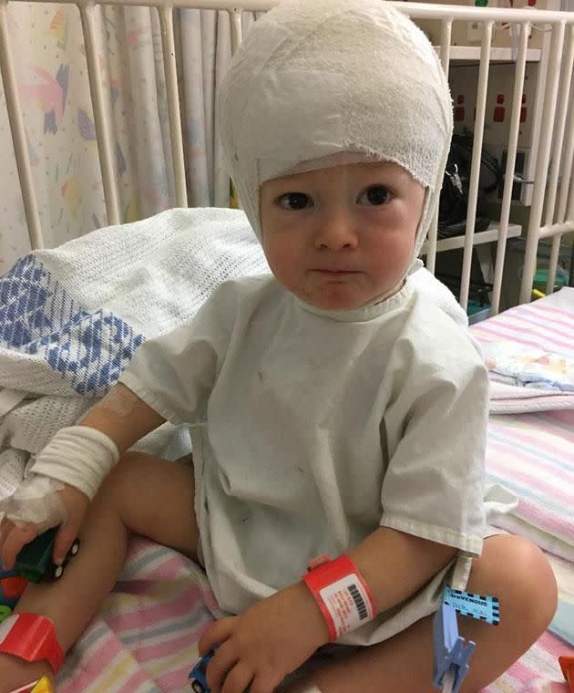 Nixon had six surgeries and 10 rounds of chemo by the time he was 18 months. Photo: Supplied