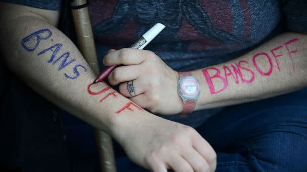 PHOTO: An activist writes the words 'Bans Off' on their arms while gathering for a rally in Washington, May 14, 2022. (The Washington Post via Getty Images, FILE)