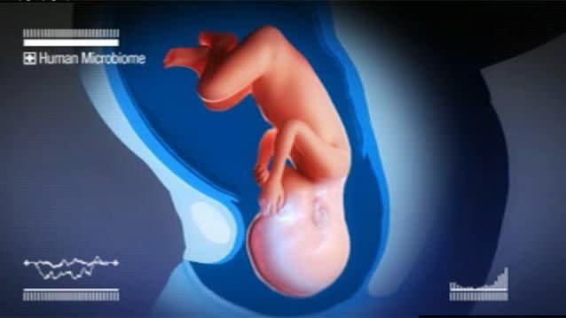 When a baby is born, their first exposure to the world of germs is through the birth canal, which can be essential to the baby's health later in life. Photo: 7News