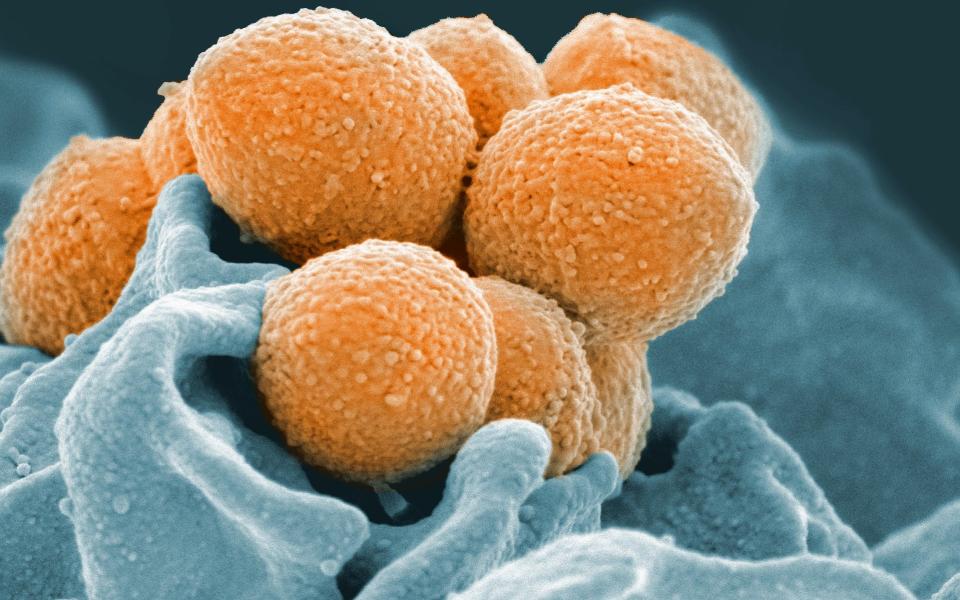 An electron microscope image of Group A Streptococcus (orange) during phagocytic interaction with a human neutrophil (blue) - AP/National Institute of Allergy and Infectious Diseases