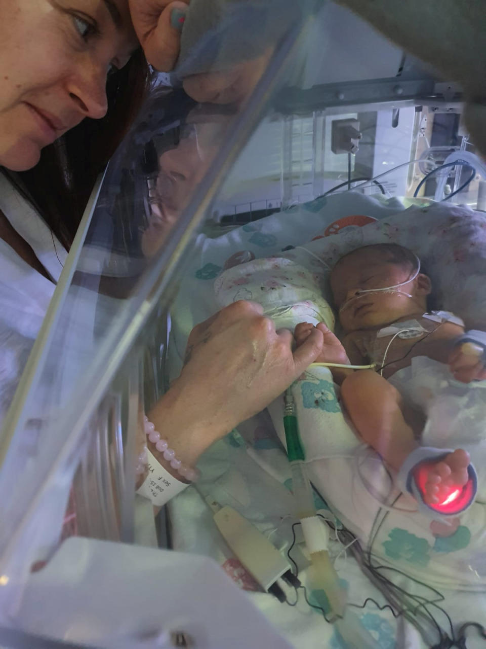 Little Robyn spent 11 days in intensive care. (SWNS)