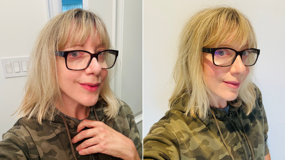 Before and after using the Miracle Balm (Photos via Sarah DiMuro).