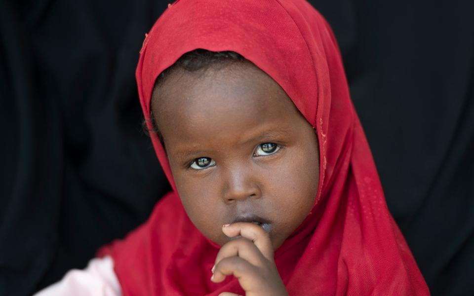 Asiyah, 2, at the Garadag-Health Centre in Somaliland - Eddie Mulholland for The Telegraph