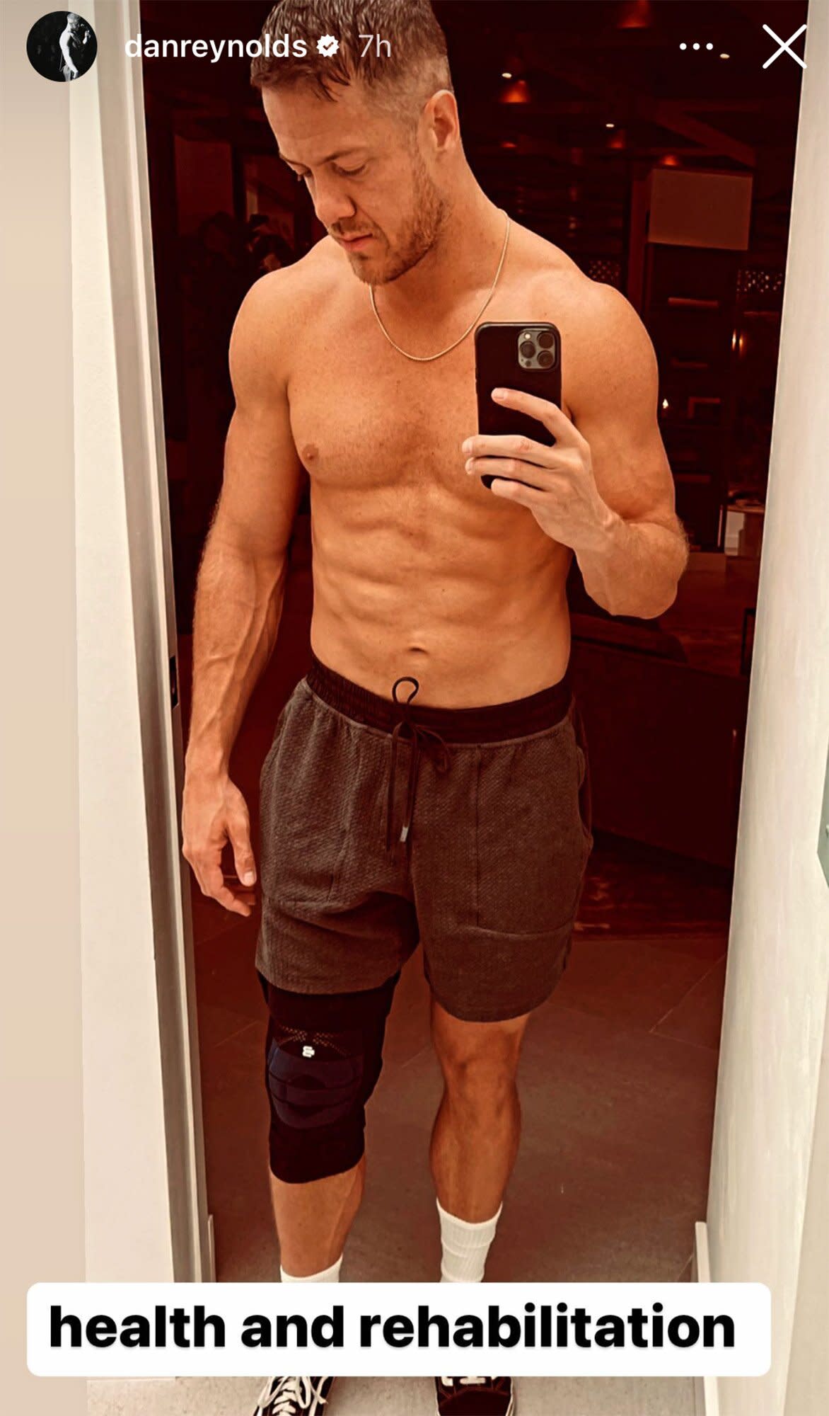 Dan Reynolds/Instagram. Imagine Dragons' Dan Reynolds Goes Shirtless After Knee Sprain: 'Health and Rehabilitation'.