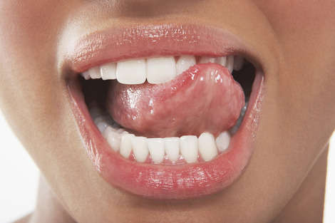 Strengthen your teeth naturally with these powerfully protective bites