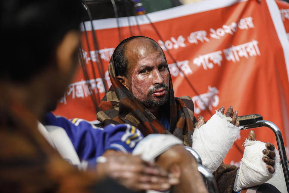 A man who said he suffered burn injuries during a protest by the main opposition BNP in October, participates in a protest in Dhaka, Bangladesh, Wednesday, Jan. 3, 2024. Authorities at the time said they arrested scores of BNP members for stoking violence and burning vehicles. They have since blamed numerous arson attacks on the opposition, which BNP has denied, saying the accusations were politically motivated and aimed at quashing their supporters as the election approaches. (AP photo/Mahmud Hossain Opu)