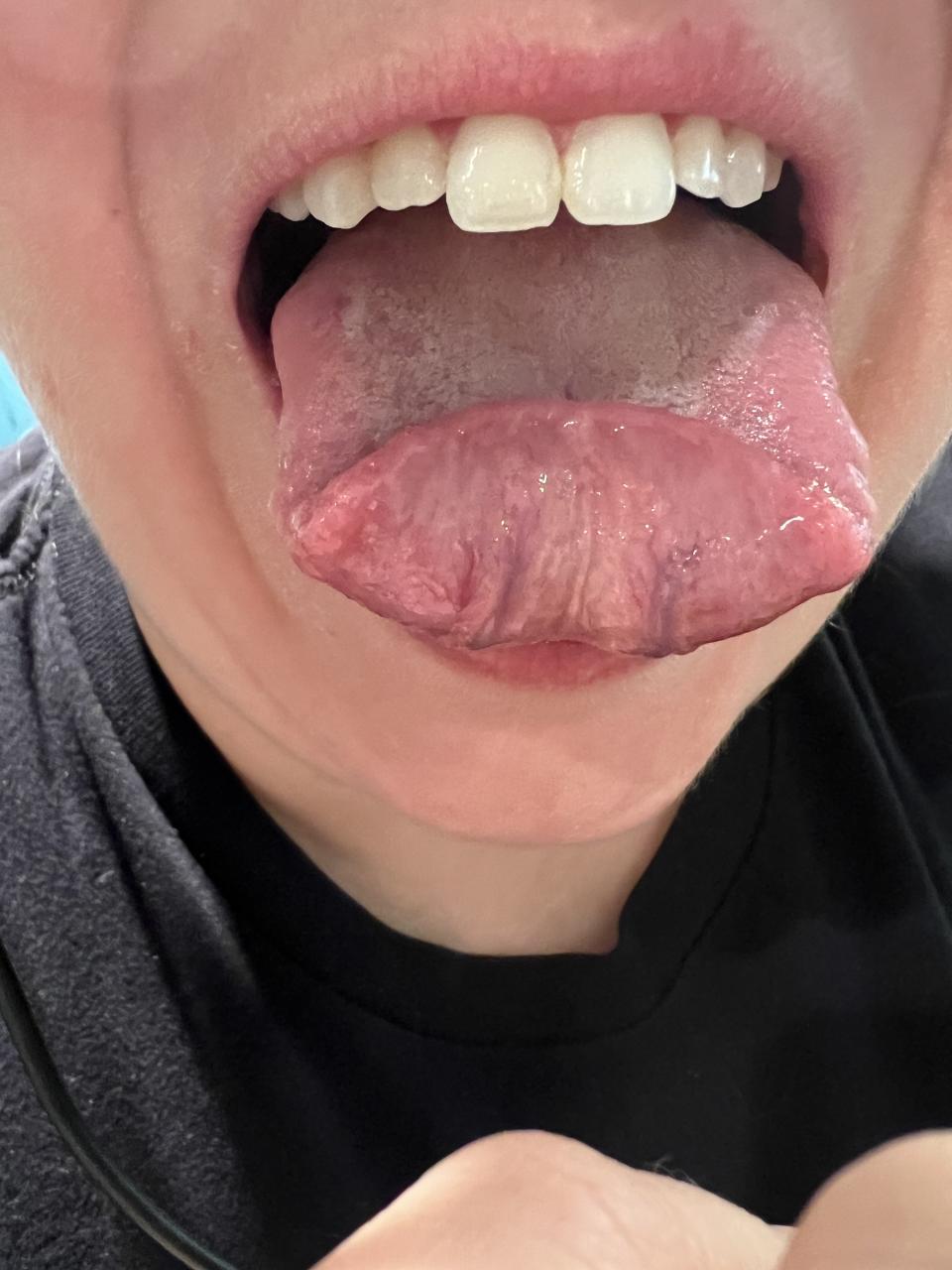 <div><p>"Only a small percentage of the population can fold their tongue in half. And I’m one of those lucky ones who can. I found this out this was rare at a Ripley’s Believe it or Not museum."</p><p>—Anonymous</p></div><span> BuzzFeed</span>