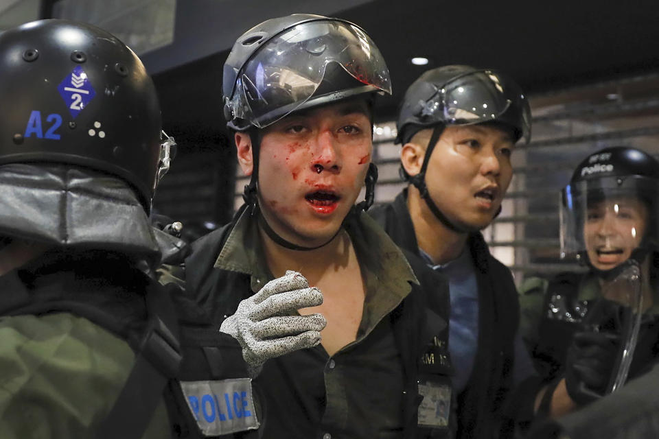 An injured policeman is escorted by his colleagues after scuffled with protesters inside a shopping mall in Sha Tin District in Hong Kong, Sunday, July 14, 2019. Police in Hong Kong have fought with protesters as they broke up a demonstration by thousands of people demanding the resignation of the Chinese territory's chief executive and an investigation into complains of police violence. (AP Photo/Kin Cheung)