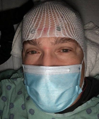 Scott Smith as he went through surgery and treatments for glioblastoma brain cancer.