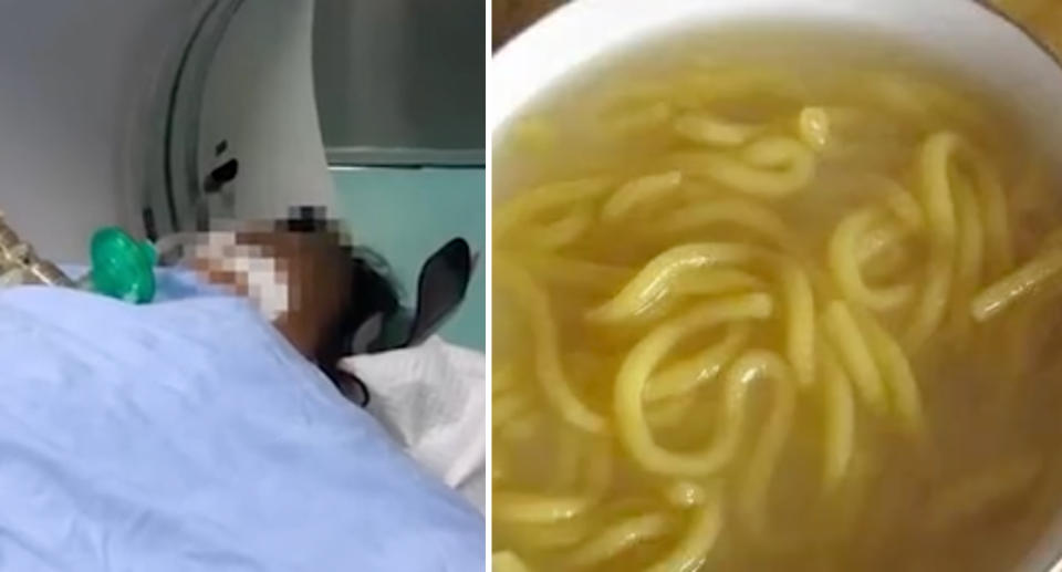 Ms. Li in the hospital before her death (left) and a picture of Suantangzi soup. Source: HongXing Video/ The Paper