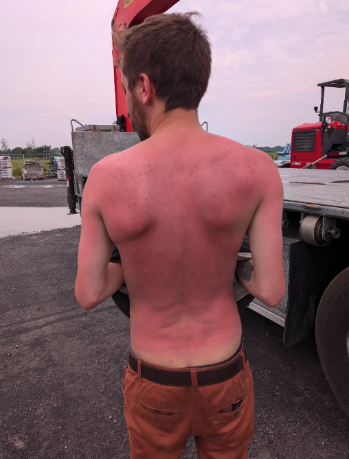 A man with a sunburned back, wearing pants, stands near construction equipment and a truck in a worksite area