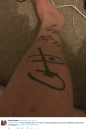 <p>Adam Johnson fan Robert Mullen had his tattoo – of the signature of his idol – removed after the ex-Sunderland and Manchester City star went to prison after an under-age sex scandal </p>