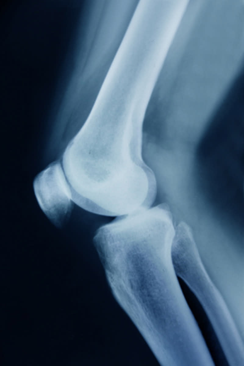 <div class="caption-credit"> Photo by: Thinkstock</div><p> <b>IN YOUR 60s AND BEYOND: <br> <br> Test This: Stand Strong</b> </p> <p> More than half of all women over 60 will break a bone as a result of osteoporosis, but you don't have to be among them. Assess your risk with a bone mineral density test, which measures the level of calcium in your hips, wrists, or spine; the lower the concentration, the more delicate your bones. If, like 27 percent of women in their 60s, you discover you have osteoporosis, talk to your doctor about treatments that can help keep you fracture-free. <br> </p>