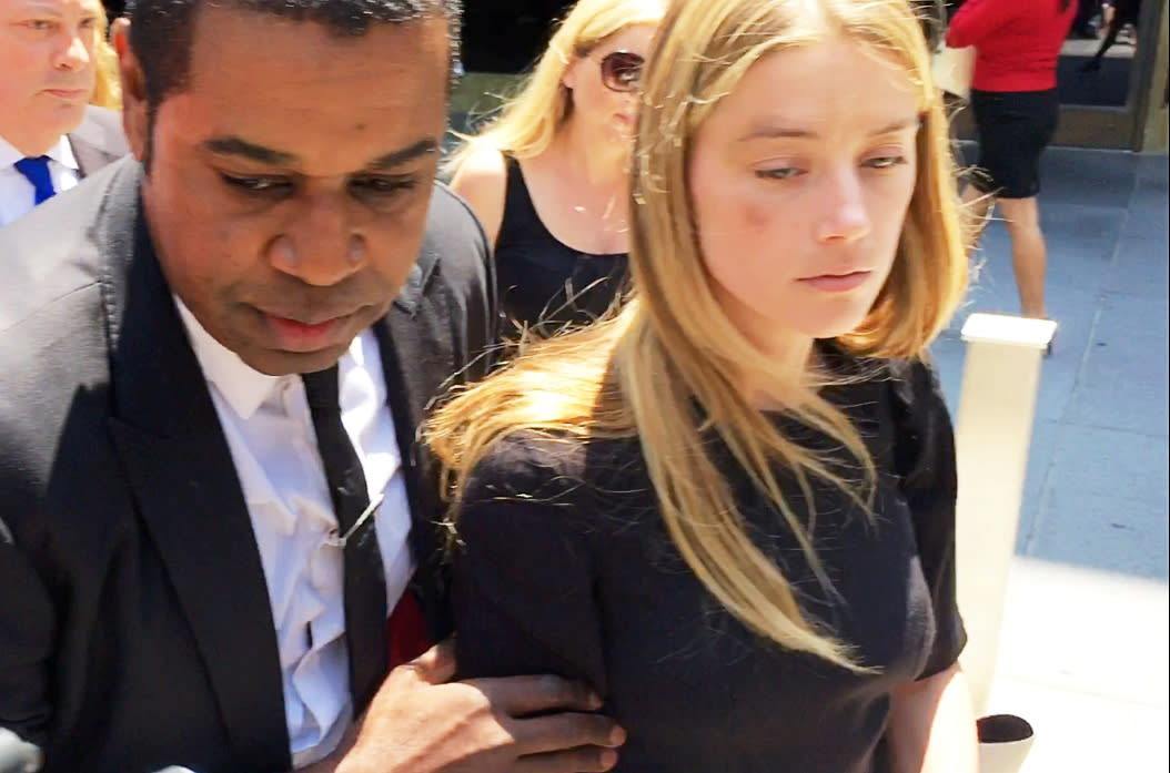 Amber Heard leaves the a Los Angeles courthouse on May 27, 2016 with what appears to be a bruise on her right cheek amid Johnny Depp divorce.