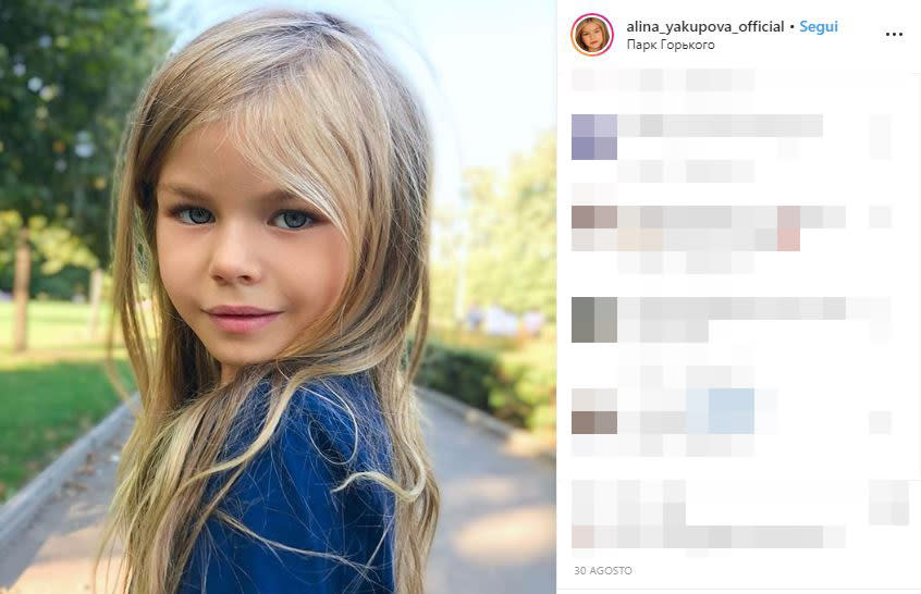 Yakupova è rappresentata dall'agenzia di moda per bambini, President Kids (PK) Management, la stessa che seguiva un'altra giovane modella russa, Anastasia Knyazeva. Quest'ultima si era guadagnata nel 2016, all'età di 6anni, lo scettro di "bambiba più bella del mondo". Prima di loro il titolo era nelle mani della modella francese Thylane Blondeau, figlia del calciatore Patrick Blondeau, che oggi ha 18 anni.