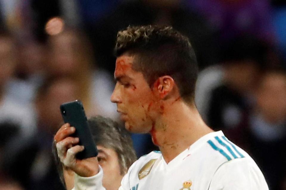 Ronaldo assesses the damage with the doctor's mobile phone: EPA