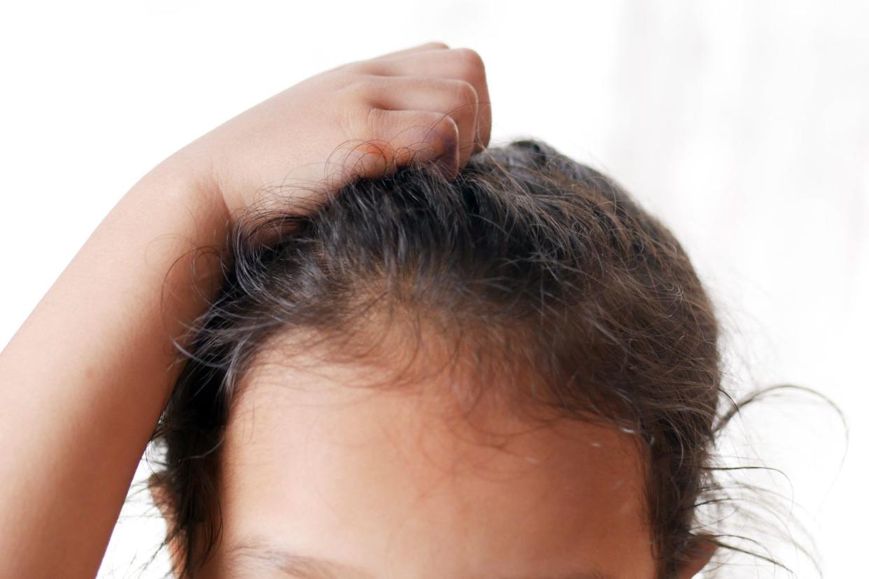 <p>Getty</p> Stock photo of a child scratching their head.