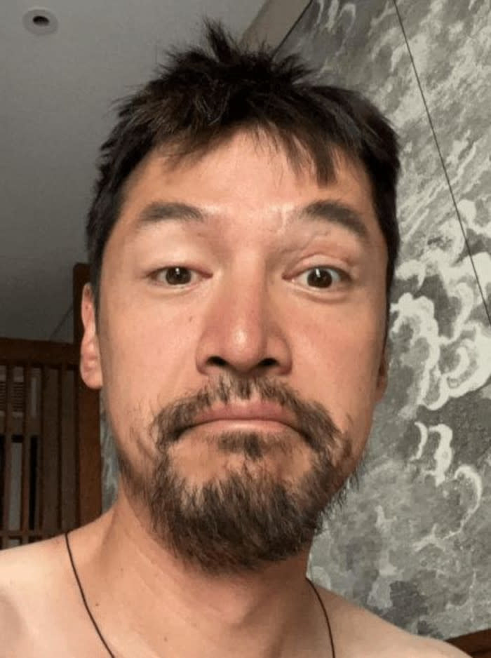  Hu Ge posted this unflattering photo of himself on social media