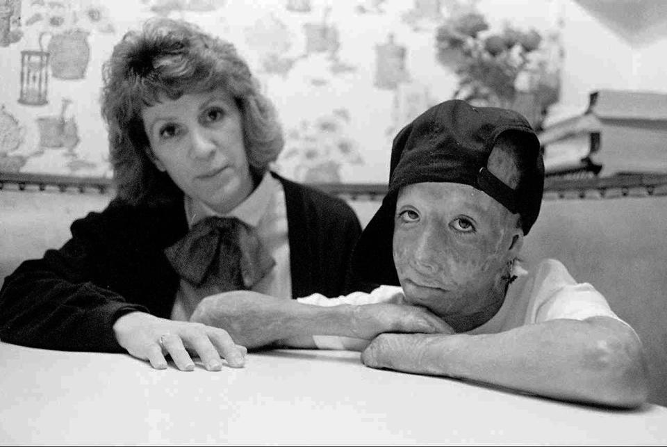 FILE - In this undated photo, David Rothenberg, right, who was set on fire by his father in an Orange County hotel room is shown with his mother, Marie Rothenberg in California. Rothenberg, known as Dave Dave, has died. He was 42. Clark County Coroner John Fudenberg says Dave died on July 15, 2018, at a Las Vegas hospital. The cause of death is under investigation. Dave was a respected Las Vegas artist and a close friend of Michael Jackson. (Paul Kuroda /The Orange County Register via AP, File)