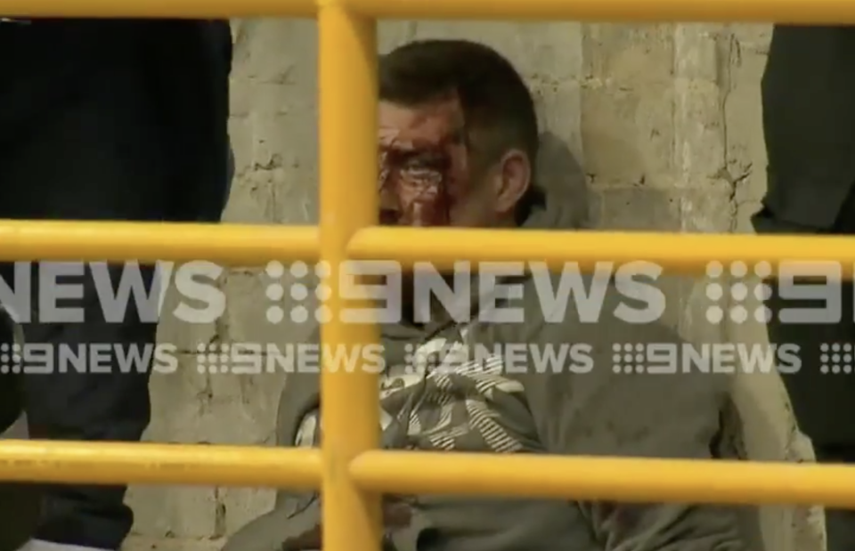 A bloodied man, believed to be Jonathan Dick, under arrest in Melbourne's CBD on Monday morning. Source: Nine News