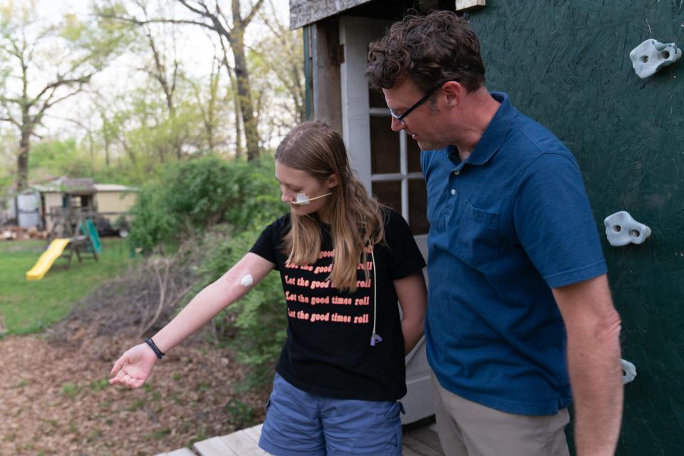 Norah Budge shows where she recently had a peripherally inserted central catheter, or PICC line, taken out. She and her father Tim Budge said she is progressing physical therapy at Children's Mercy Hospital in Kansas City, Missouri.