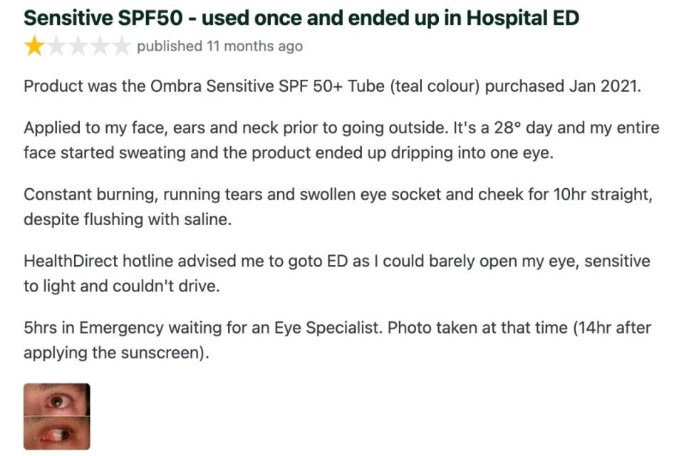 Product Review of Aldi Ombra sunscreen putting woman in hospital