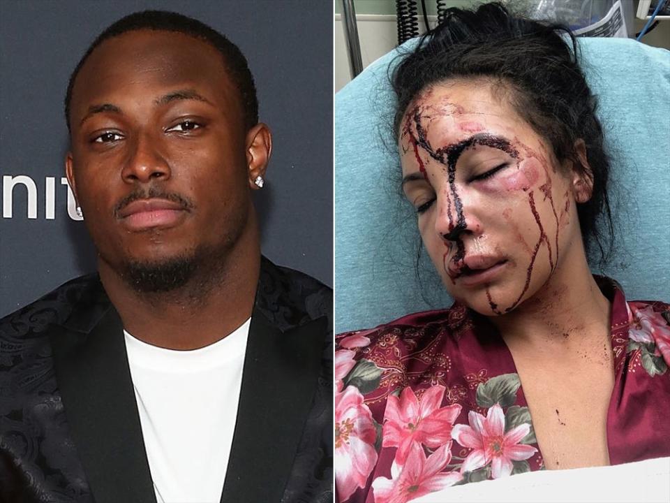 LeSean McCoy and his ex-girlfriend, Delicia Cordon, after she was assaulted in July by an unknown assailant