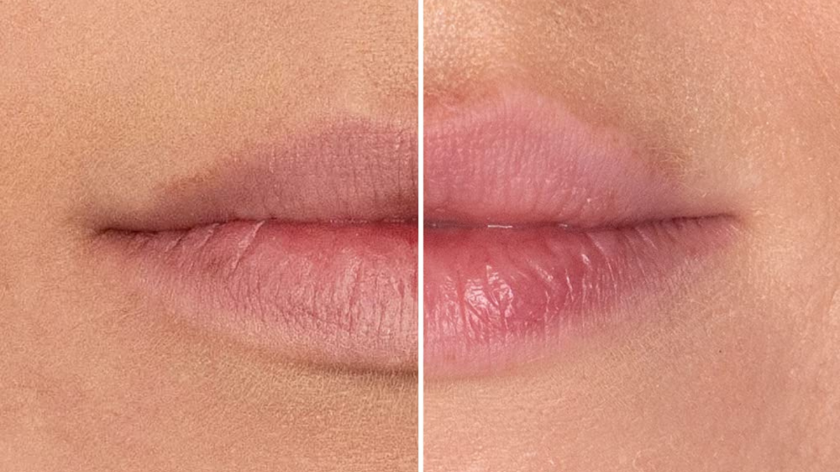 Shoppers say this volumizing gloss gives them a plump pout without the burning sensation