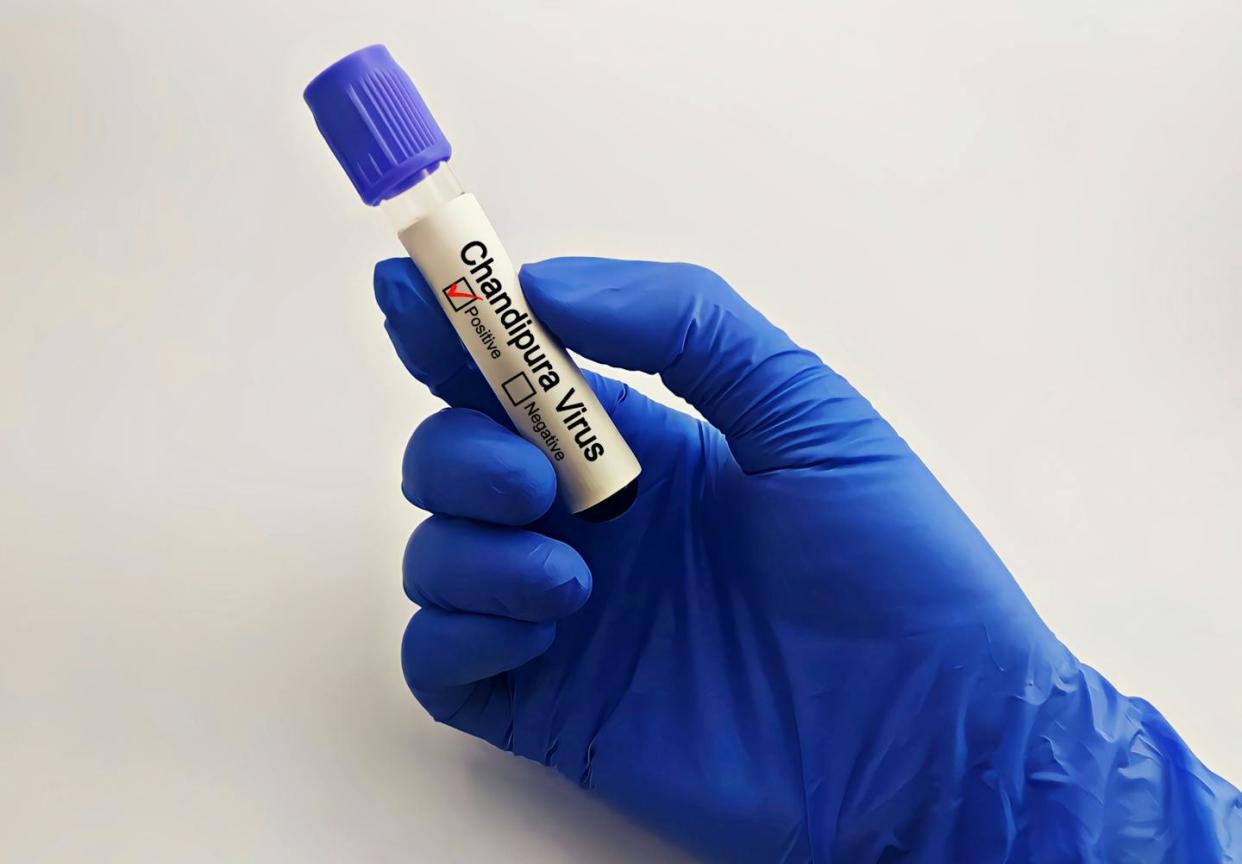 <a href="https://www.shutterstock.com/es/image-photo/blood-sample-patient-positive-test-chandipura-2494188845" rel="nofollow noopener" target="_blank" data-ylk="slk:faniadiana24/Shutterstock;elm:context_link;itc:0;sec:content-canvas" class="link ">faniadiana24/Shutterstock</a>