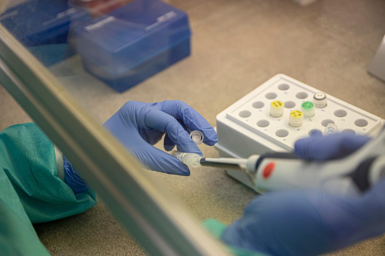 Clinical Laboratory Scientist Thanh Le, 37, of Lansing prepares the master mix formula later to be combined with the extracted DNA sample to test for Orthopox at the Sparrow Hospital lab in Lansing, on Thursday, Aug. 11, 2022. The combined sample is placed in the Cobas Z 480 machine, which analyzes the sample for Orthopox. If the result turns out to be positive, they rerun the process to specifically test for Monkeypox.