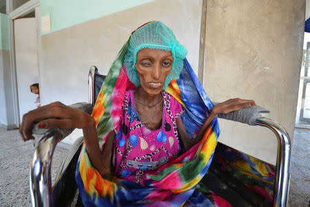 Saida Ahmad Baghili, 18, sits in a wheelchair at the al-Thawra hospital where she receives treatment for severe acute malnutrition in the Red Sea port city of Houdieda, Yemen October 25, 2016. REUTERS/Abduljabbar Zeyad