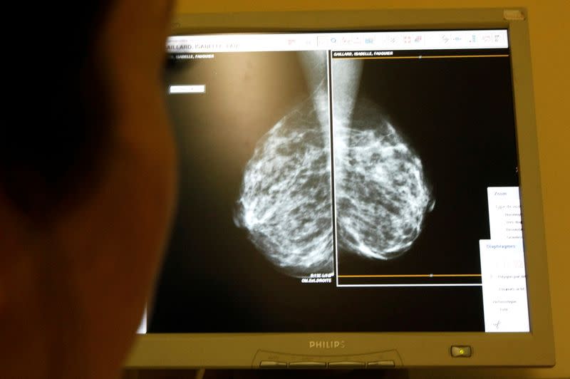 FILE PHOTO: A woman undergoes a mammograms, a special type of X-ray of the breasts, which is used to detect tumours as part of a regular cancer prevention medical check-up at a clinic in Nice