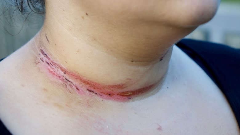 ATV-riding teen survives close call with cable on west Quebec trail