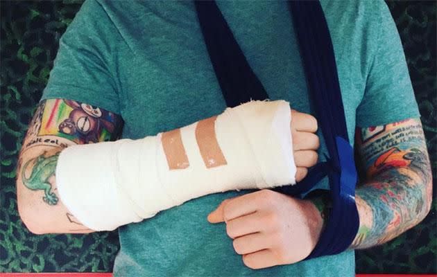 Ed posted this photo of his broken arm onto his Instagram page letting fans know that he will be 'OK'. Source: Instagram