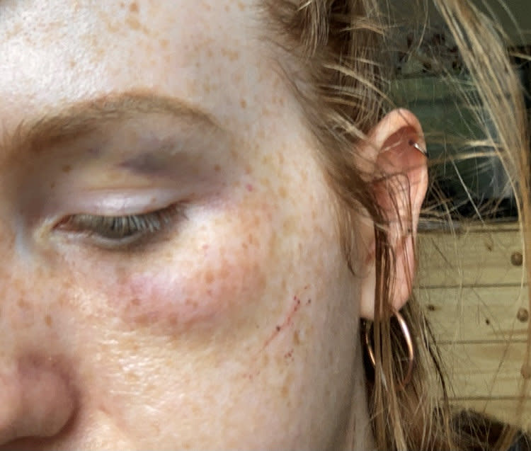 She was assaulted by three men in Castle Park. (SWNS)