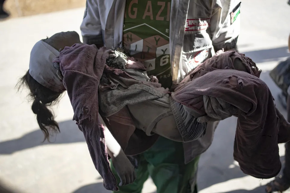A Palestinian wounded in Israeli bombardment of the Gaza Strip is brought to a hospital in Khan Younis, Sunday, Nov. 6, 2023. (AP Photo/Fatima Shbair)
