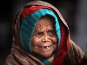 An leprosy infected woman waits for her turn to be treated by the volunteers of US based Arpan Global Charities (AGC), a medical volunteer organization, in Amritsar, India, Friday, Jan. 22, 2010. AGC provides free medical services to the medically underserved populations of the world. (AP Photo/Altaf Qadri)