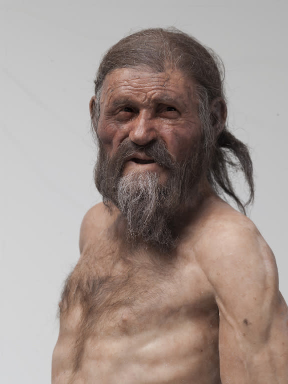 Ötzi the Iceman, a well-preserved mummy discovered in the Alps in 1991, carried an ancient pathogen in his stomach and intestines.