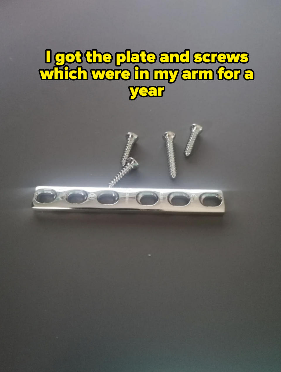 A metal orthopedic plate with five holes alongside four screws on a plain background