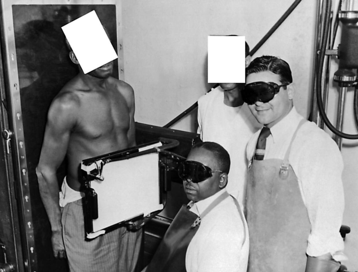 <span>An African American man being X-rayed as part of the ‘Tuskegee experiment’. </span><span>Photograph: Gado Images/Alamy</span>