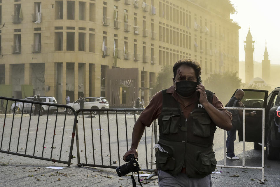 一名身穿記者背心的攝影師在爆炸現場受傷。