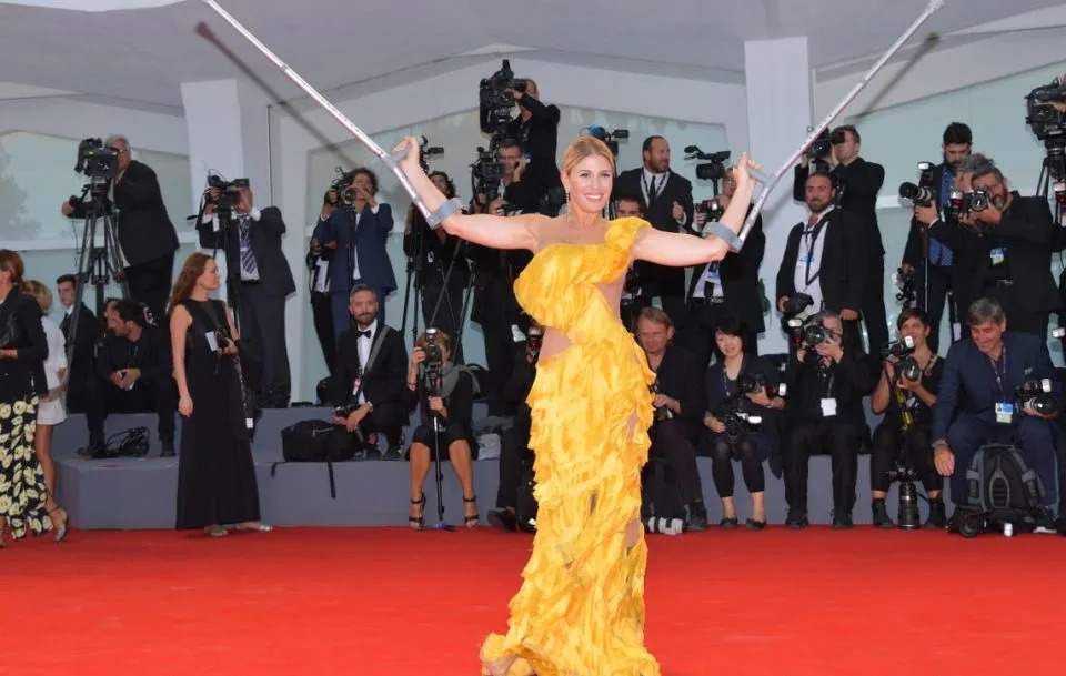 Despite the injury and wardrobe malfunction the socialite was still having a blast on the red carpet. Source: Getty